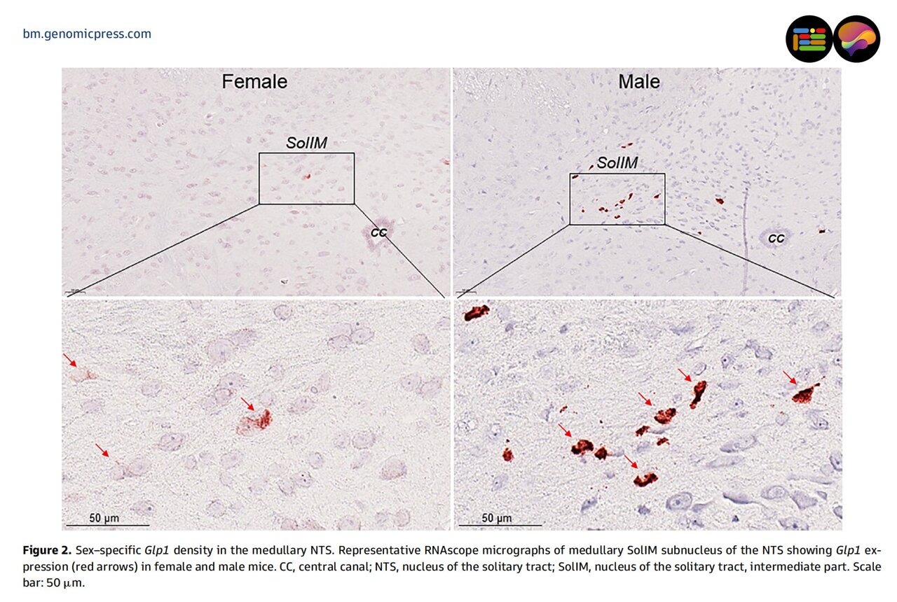Scientists Map Brain Differences in Weight-Loss Drug Effects - Image 2