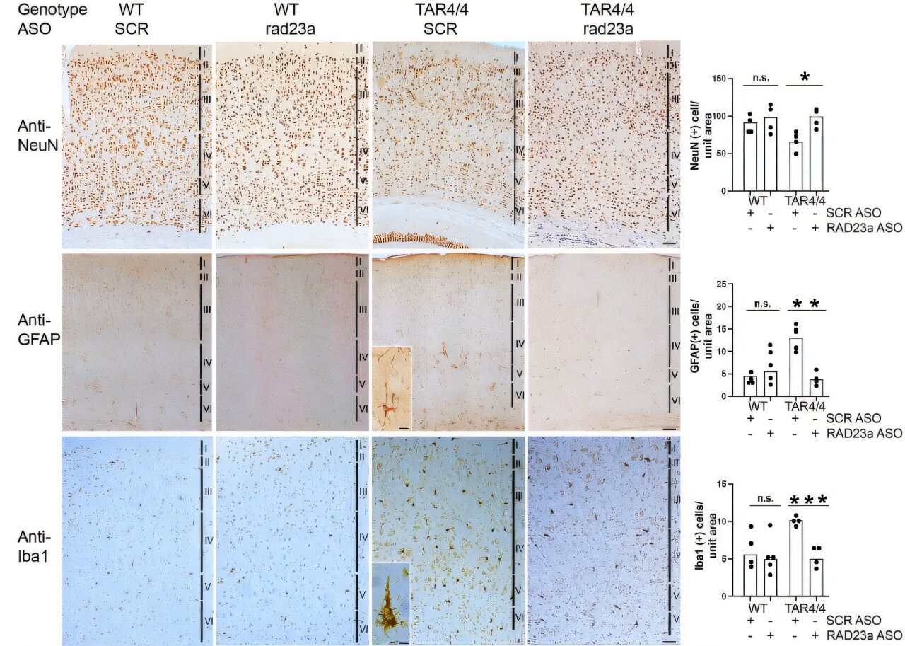Scientists Extend Lifespan in ALS Mice by 30%