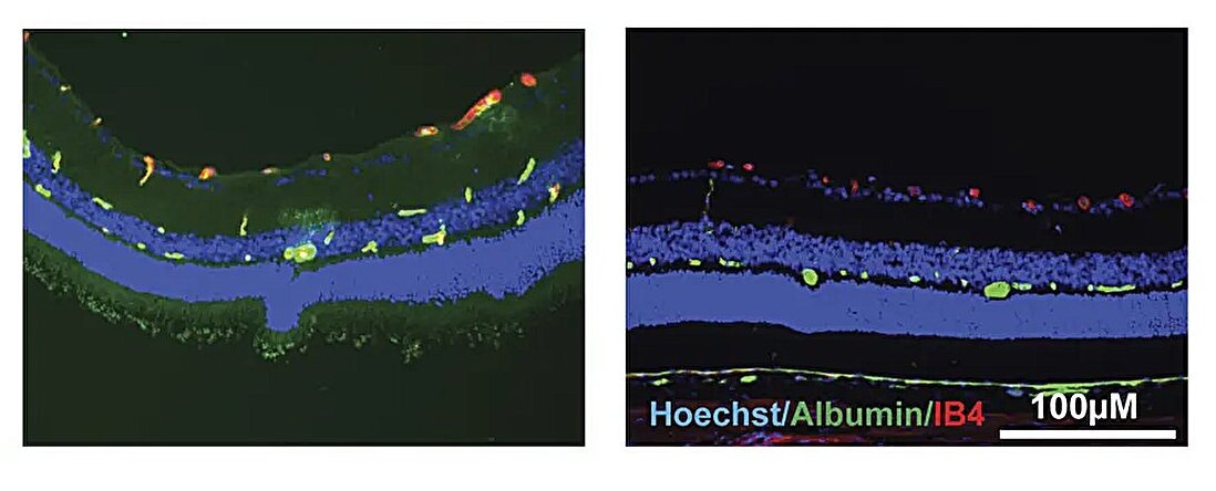 U-M Scientists Find Molecule to Halt Vision Loss