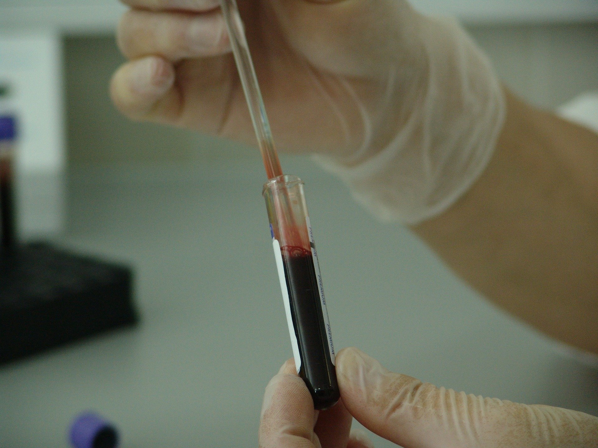 Compact disc-shaped medical device for automated cancer detection from blood samples