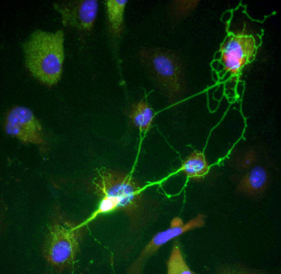 Close-up microscopic view of glowing nerve cells and neural pathways in scientific imaging