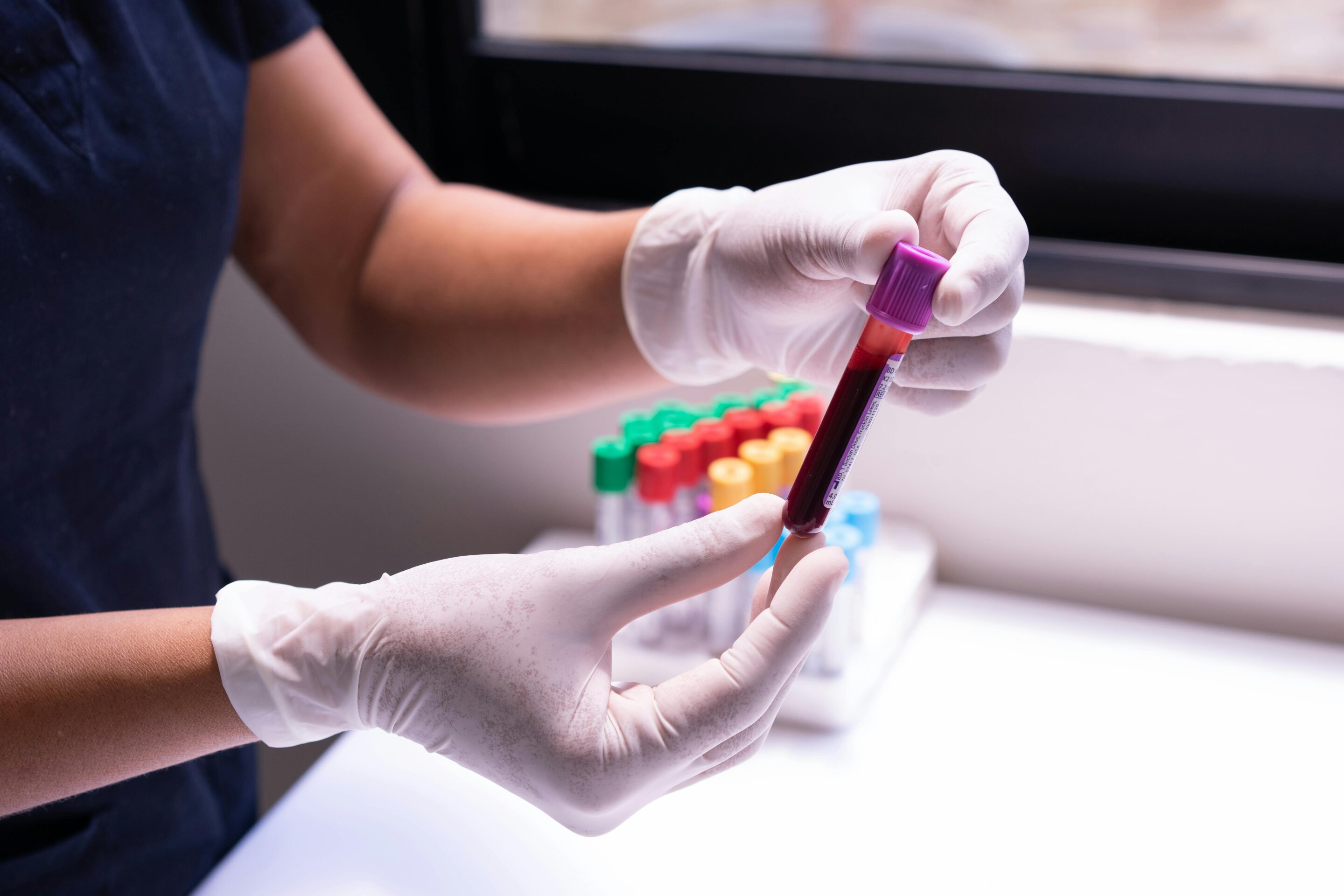 UCLA Blood Test Detects Multiple Cancers for Under $20