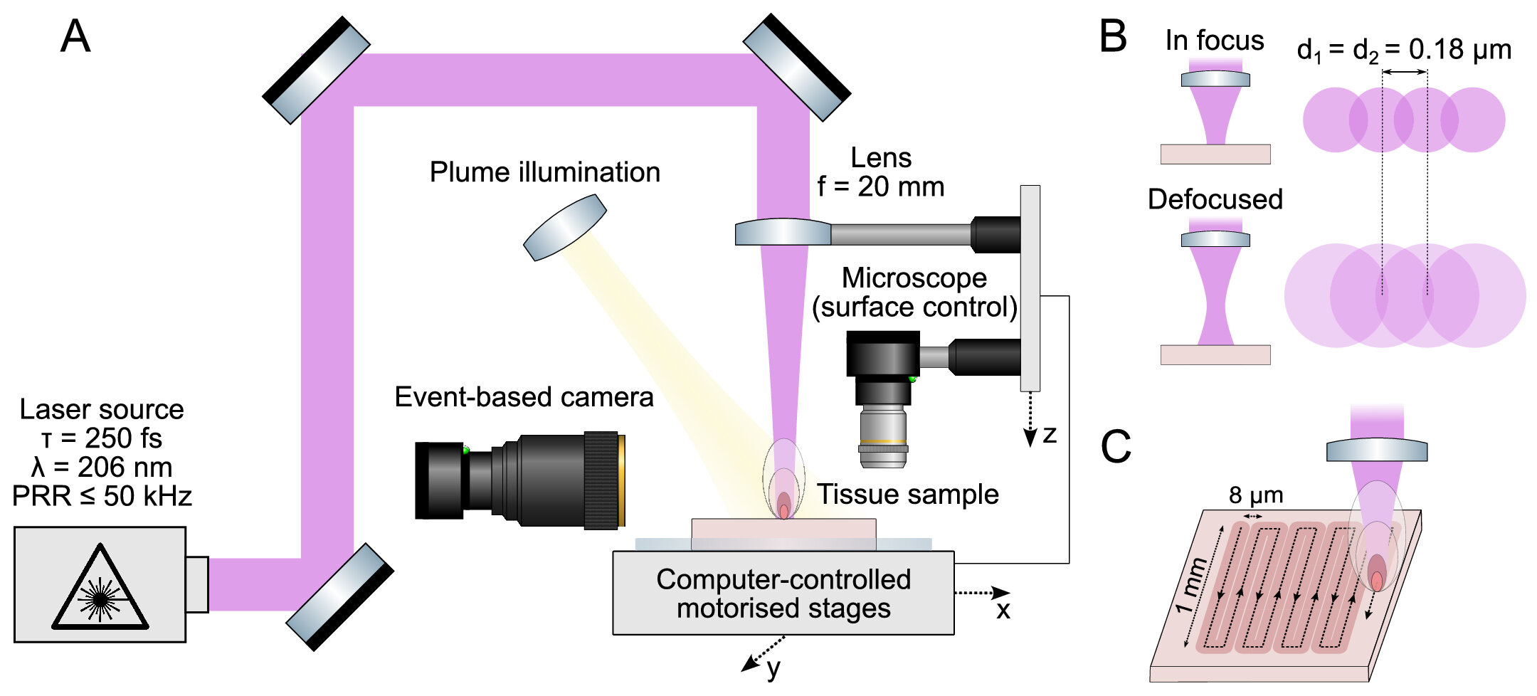 Eye Surgery Laser Could Remove Brain Tumors with Precision
