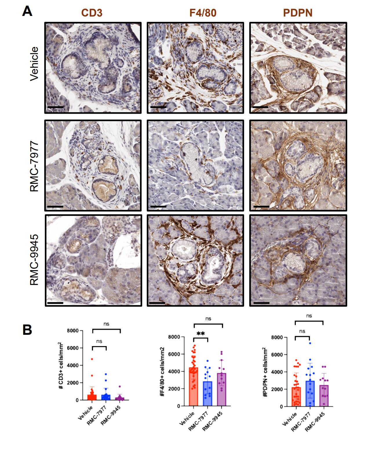 Scientists Stop Pancreatic Cancer Before It Starts in Mice