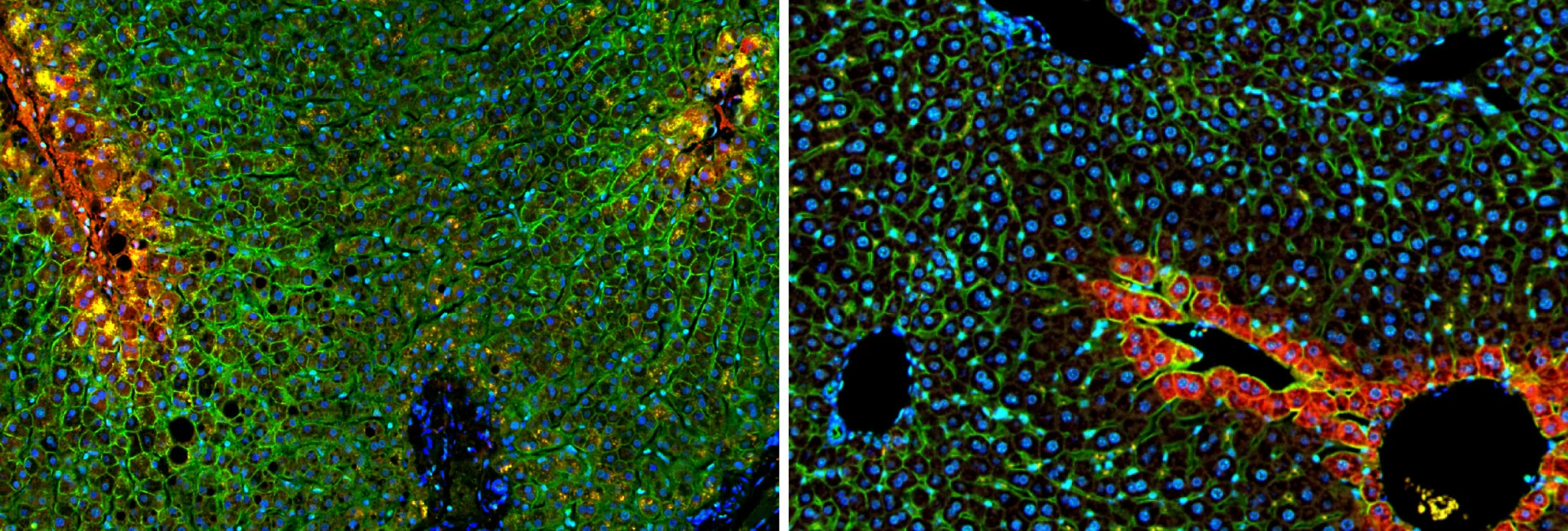 Scientists Map Human Liver in 8 Zones, Not 3