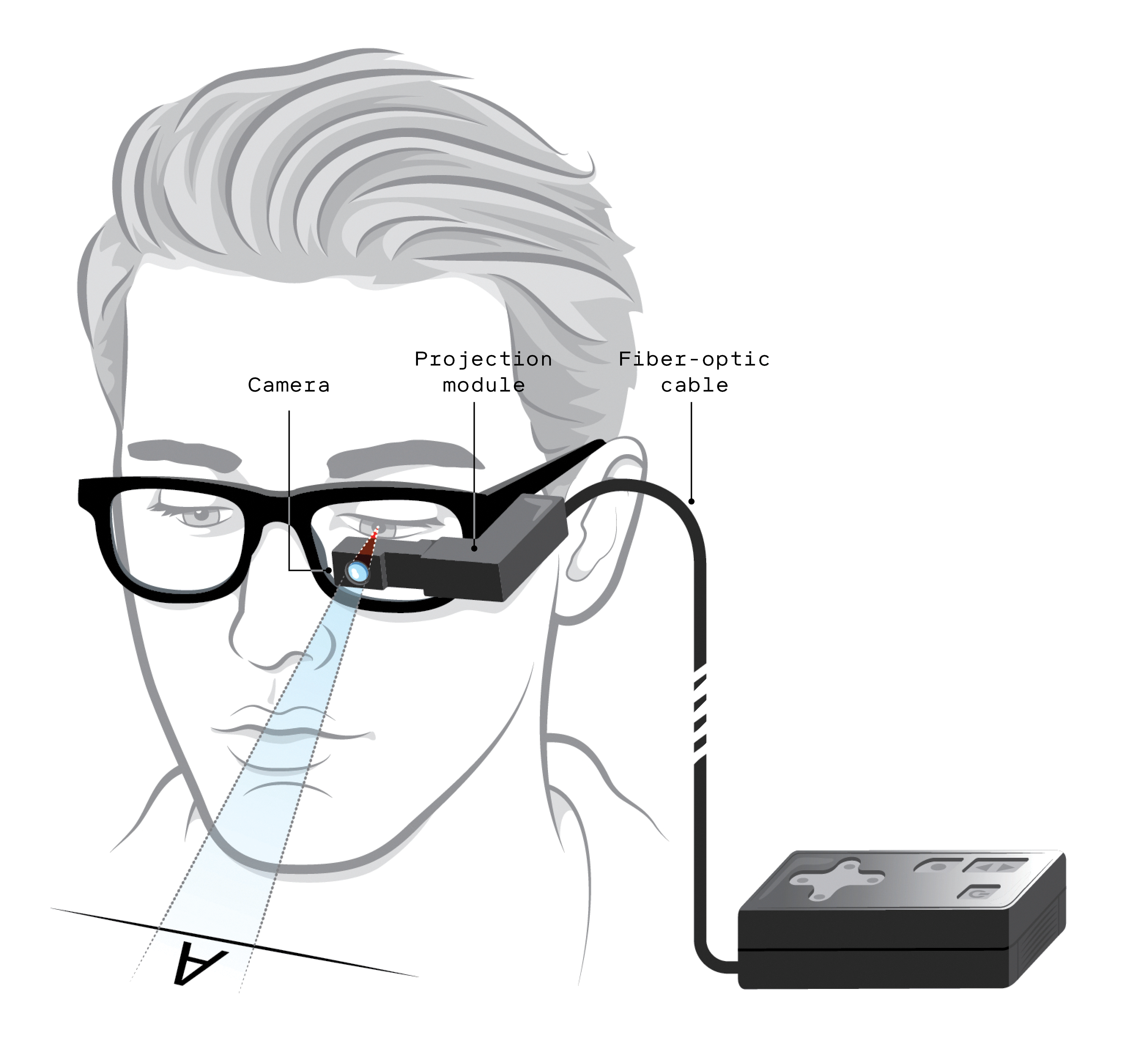 New Implant Restores Sight for 5 Million AMD Patients - Image 3