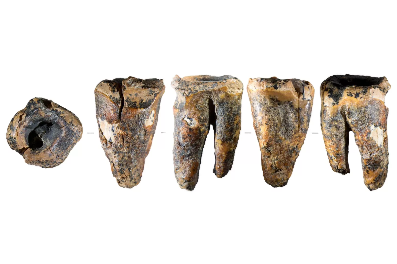 Neanderthals Performed Dentistry 59,000 Years Ago