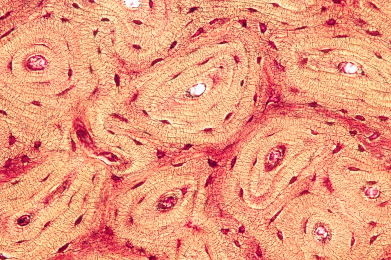 Microscope image showing oval-shaped osteocyte bone cells that release healing molecules when compressed