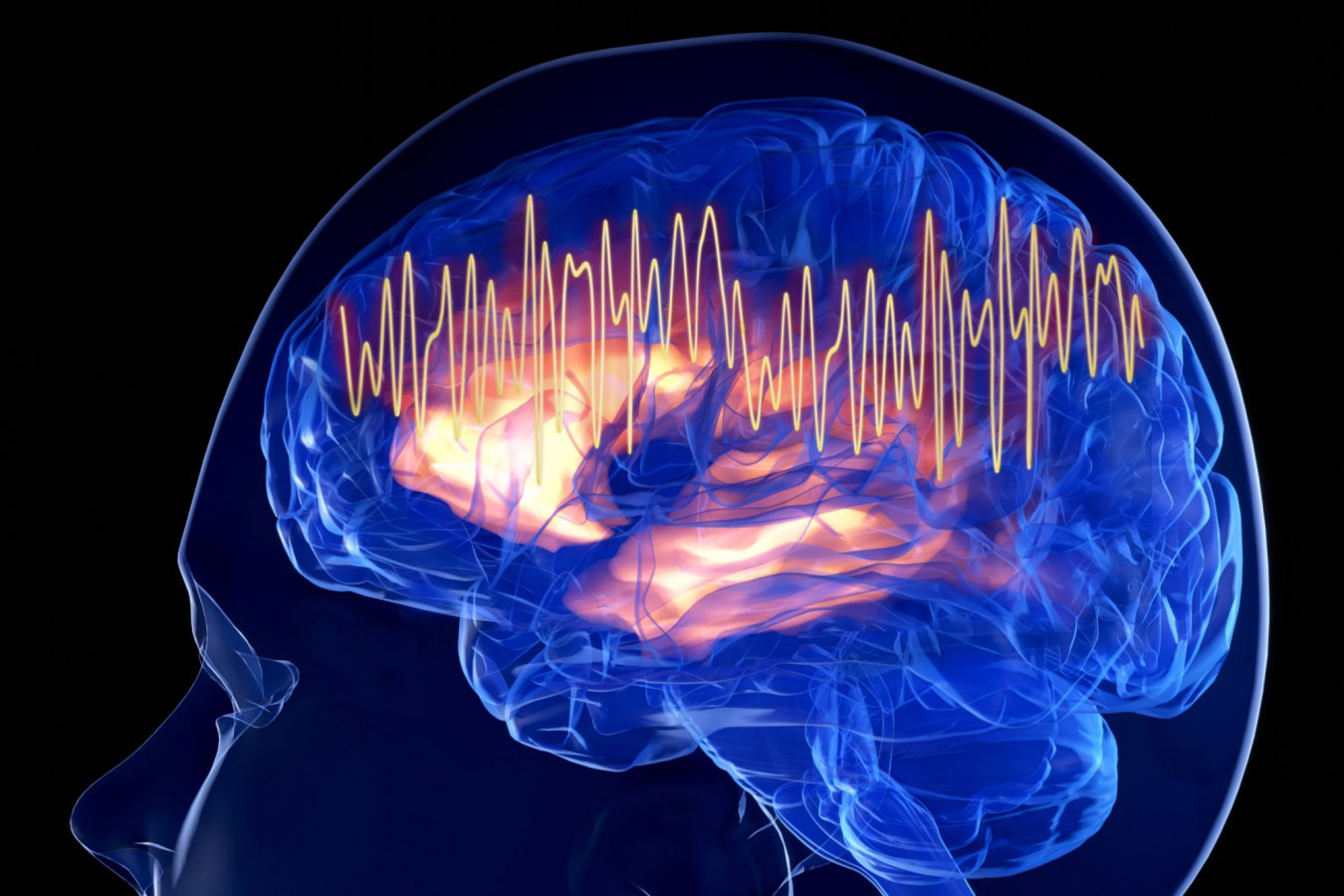 Brain Training Session Lifts Mood for Depression Patients