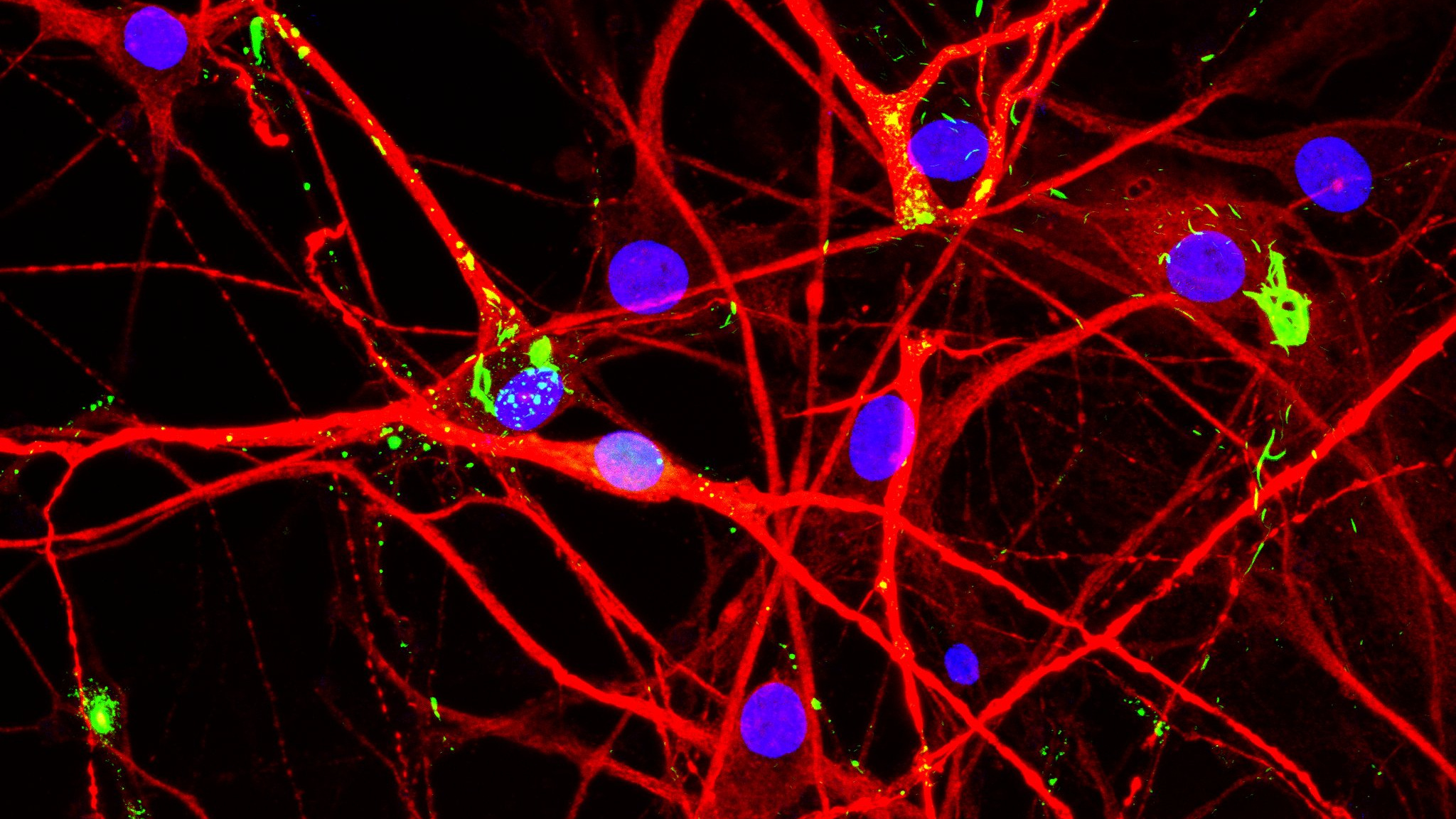 New Research Could Free CML Patients From Lifelong Drugs