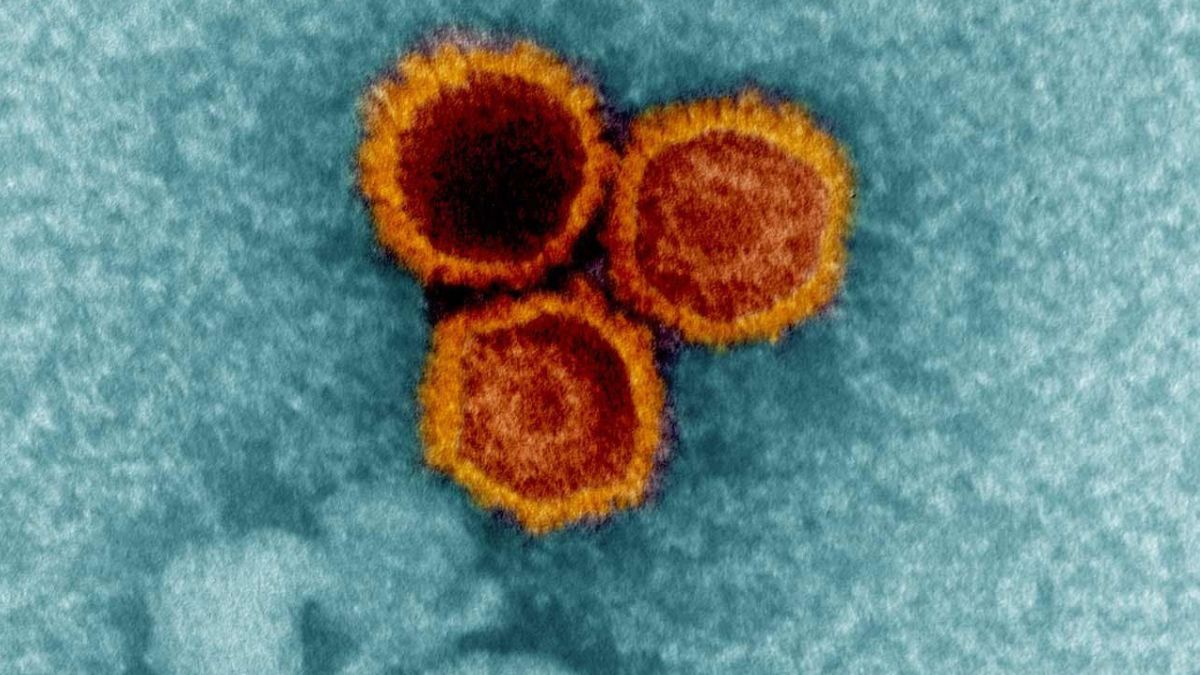 Colorized electron micrograph showing three orange-red Epstein-Barr virus particles against dark background