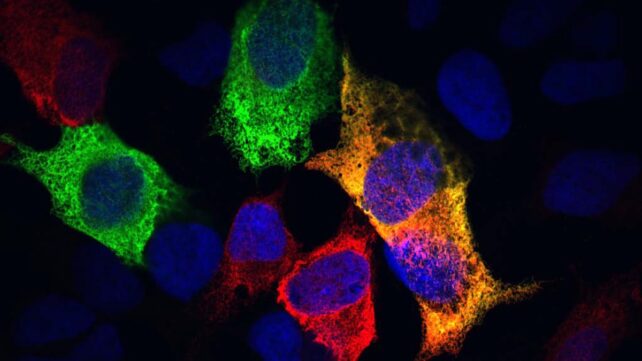 Scientists Find Cell Process That May Slow Aging - Image 2