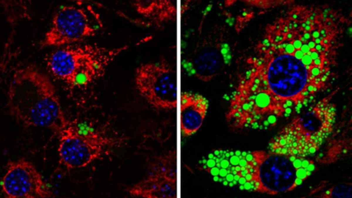 Scientists Find 'Mitch' Protein Controls Fat Cell Growth