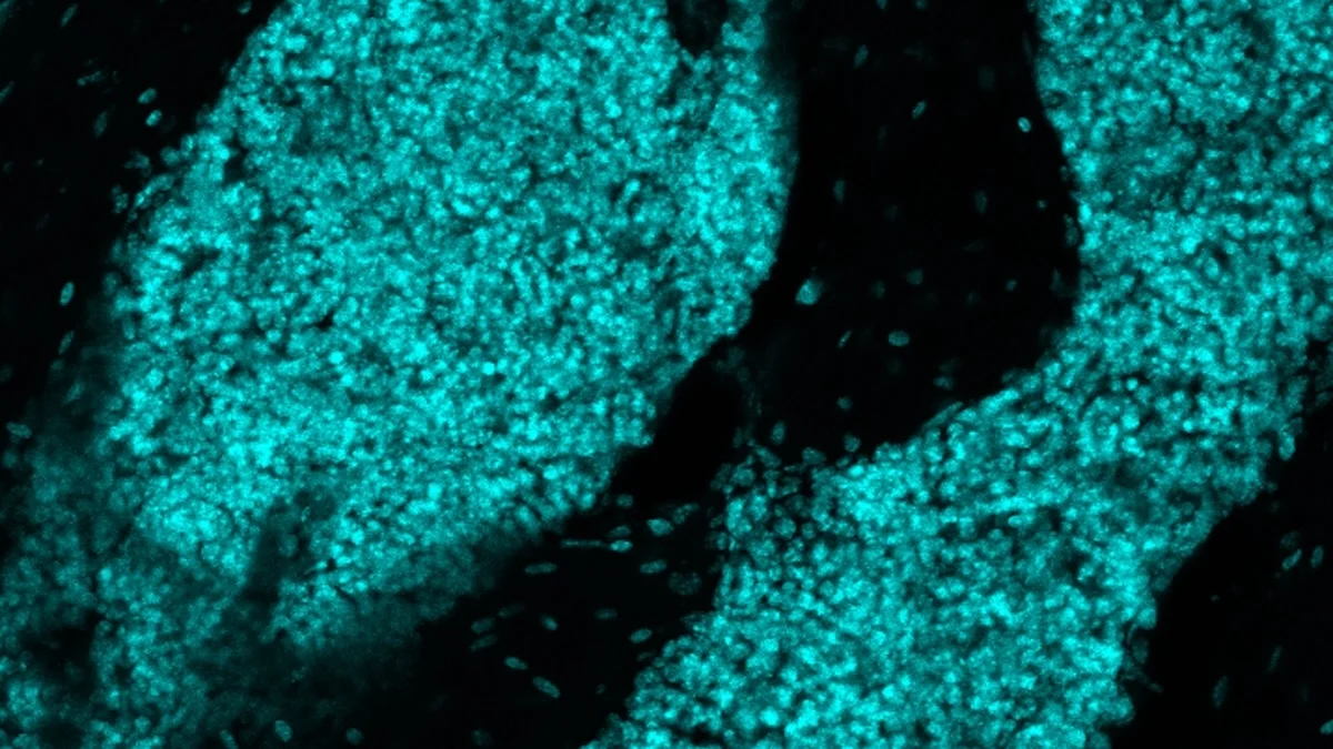 Scientists Find New Immune Organ Hidden in Mouse Skulls
