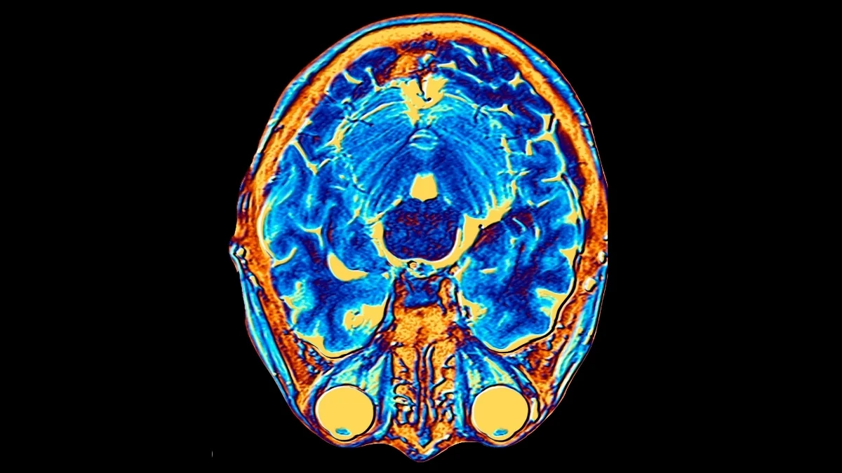 Scientists Discover Human Brain Has Two Separate Origins