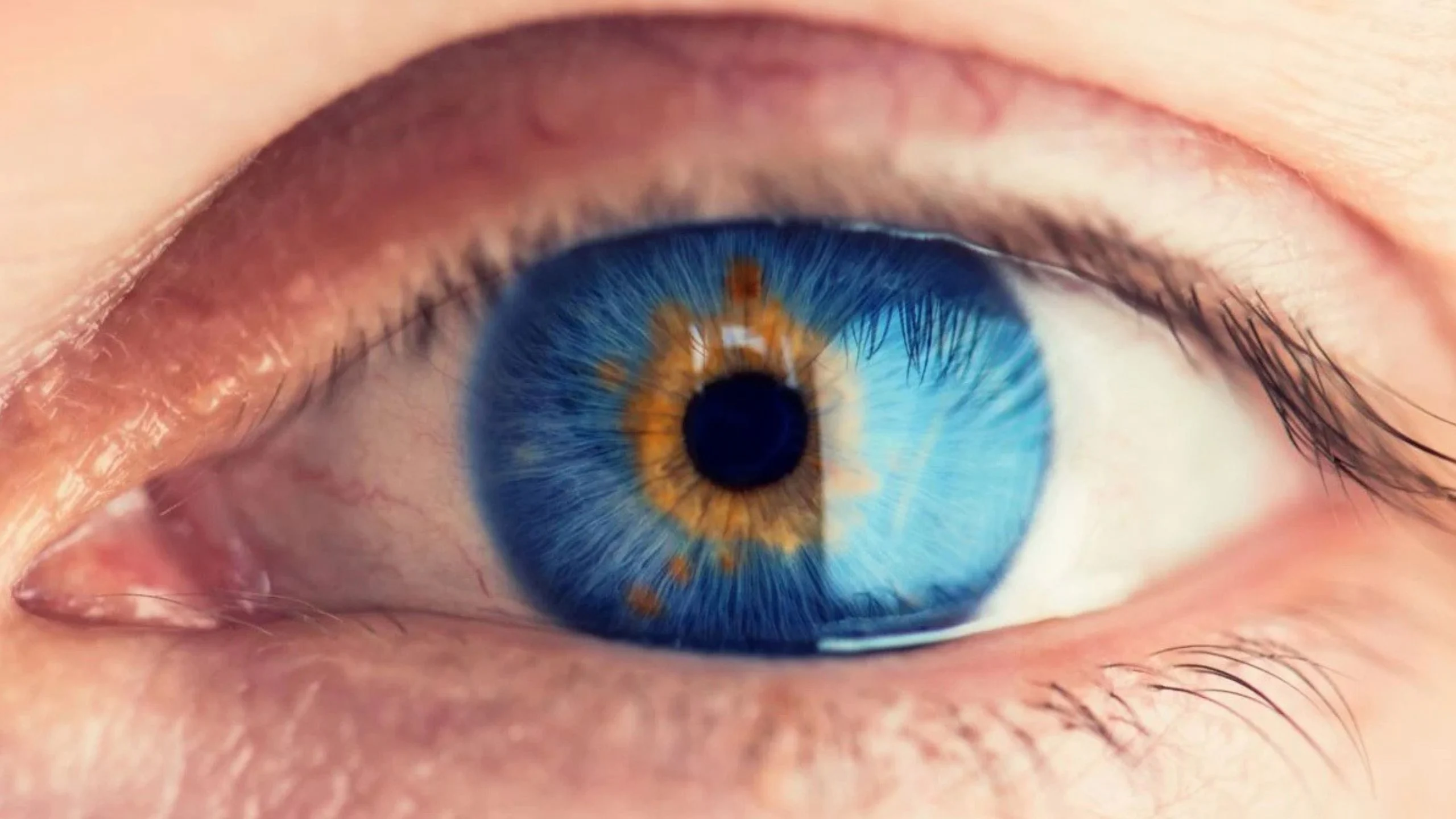 Gene Therapy Restores Partial Vision in Blind Patients