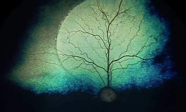 Gene Therapy Repairs Damaged Vision in Dogs, Maybe Humans - Image 4
