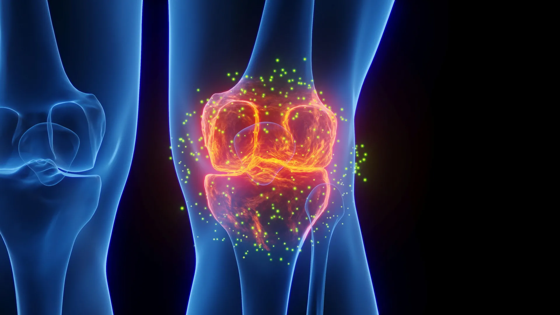 Stanford Scientists Regrow Cartilage, Reverse Arthritis