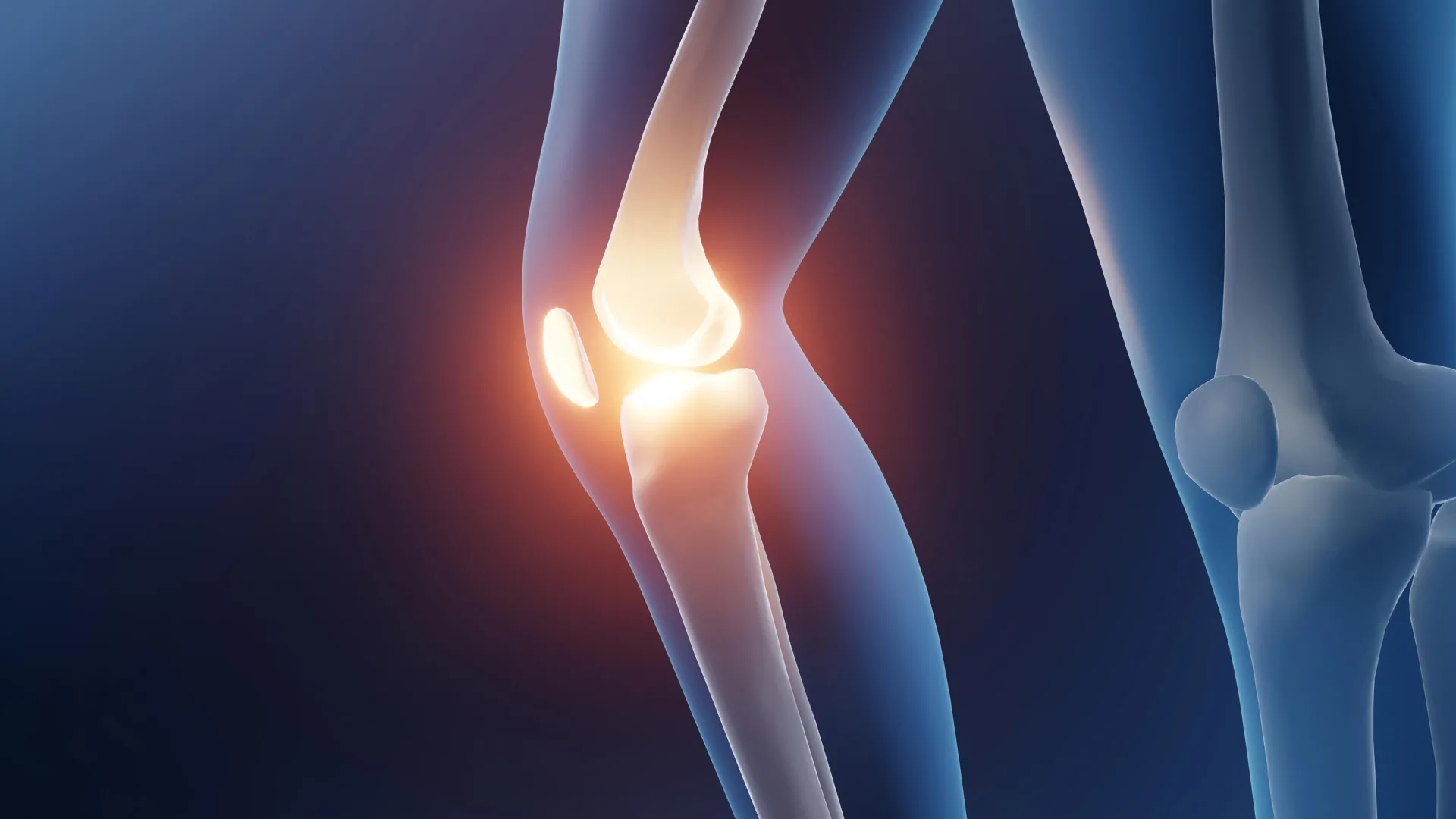 Walking and Swimming Beat Knee Arthritis Pain in 217 Studies