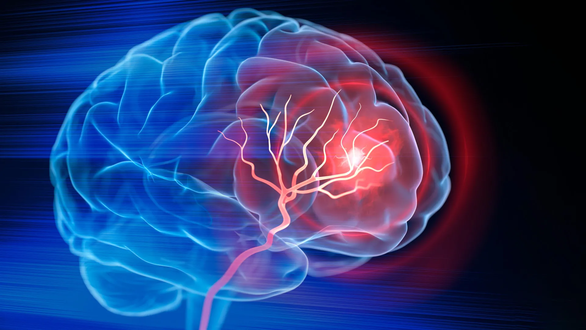 Scientists Reverse Alzheimer's Gene Damage in Major Study