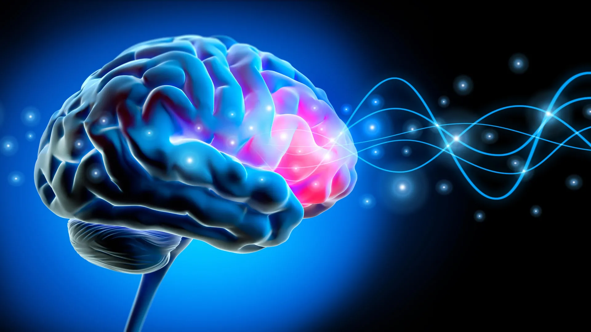 Medical illustration showing brain with electrical signals and deep brain stimulation electrodes in Parkinson's patient