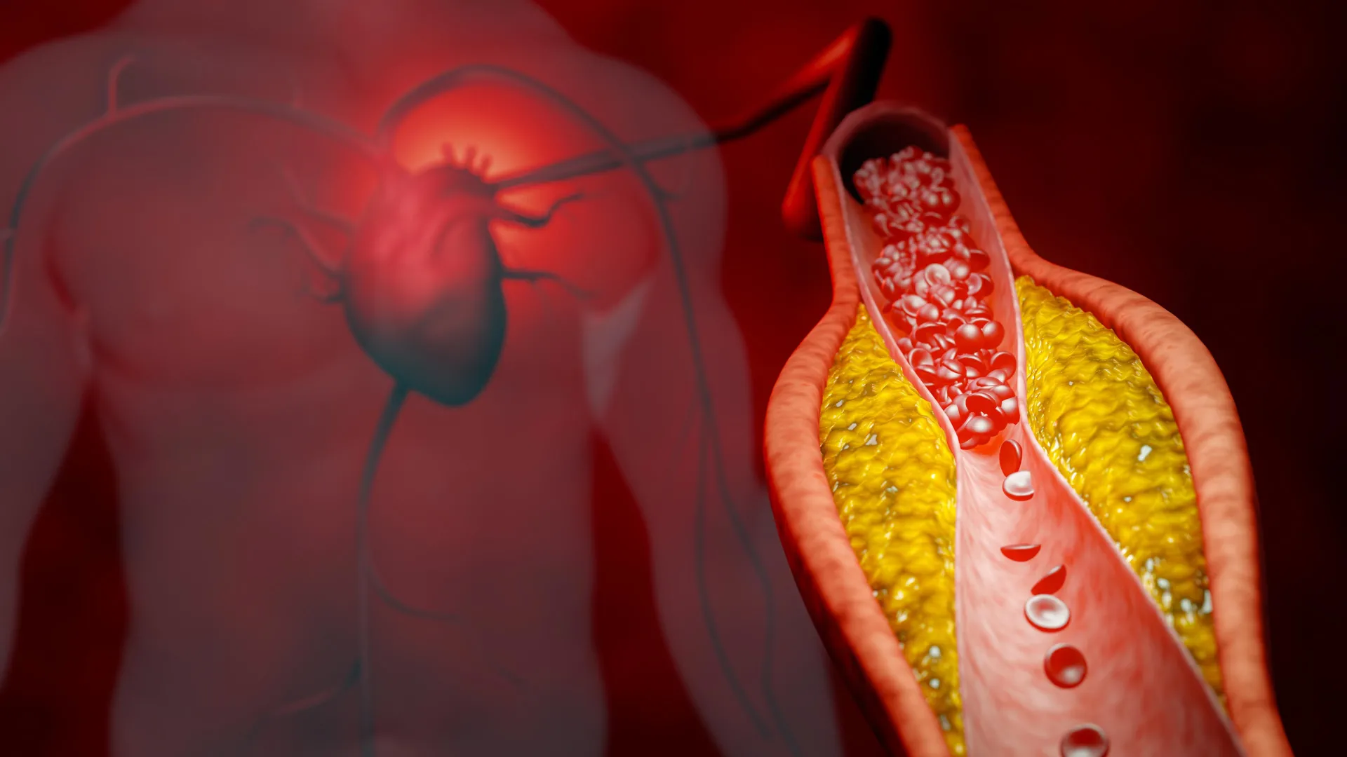 DNA Treatment Cuts Cholesterol 47% With Single Shot