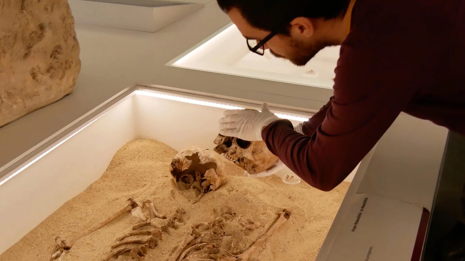 12,000-Year-Old Burial Solves Ancient Medical Mystery