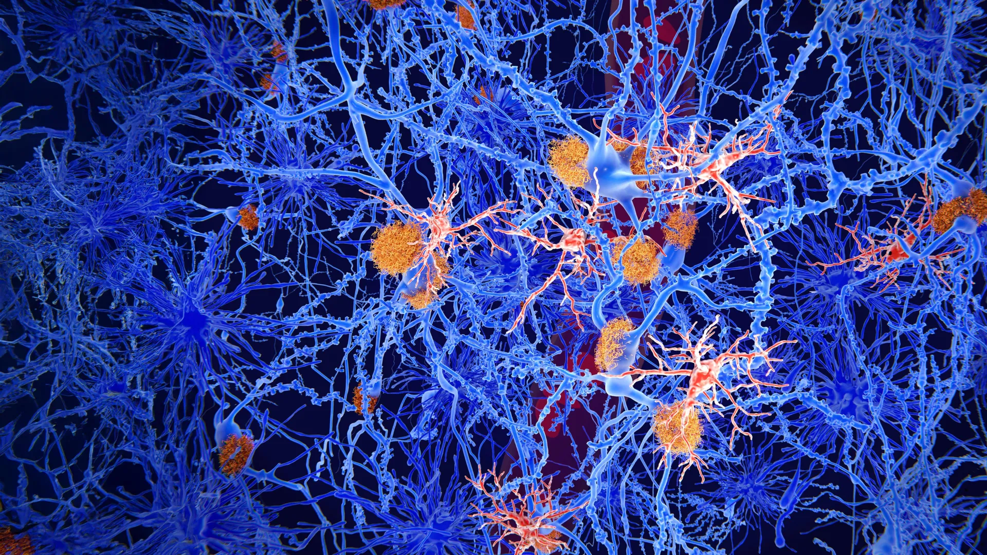Microscopic view of brain immune cells surrounding and protecting neurons from damage