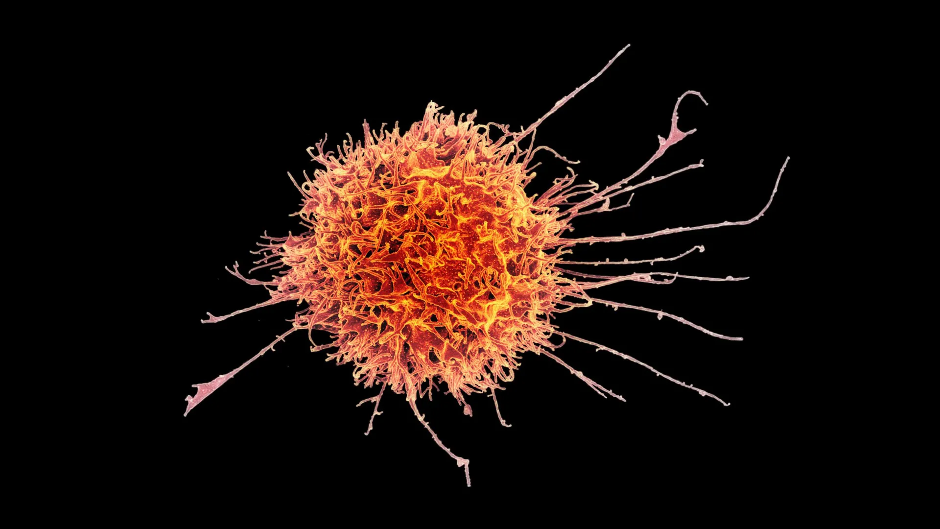 Stanford Supercharges Immune Cells to Fight Solid Tumors