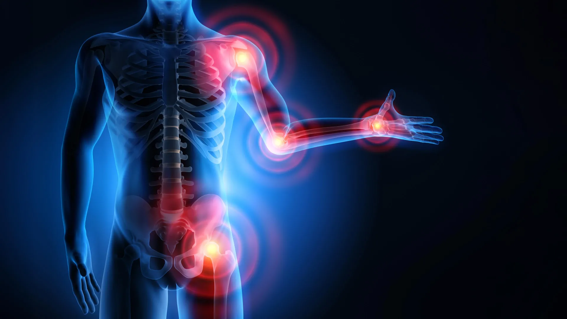 Scientists Find Body's "Off Switch" for Inflammation