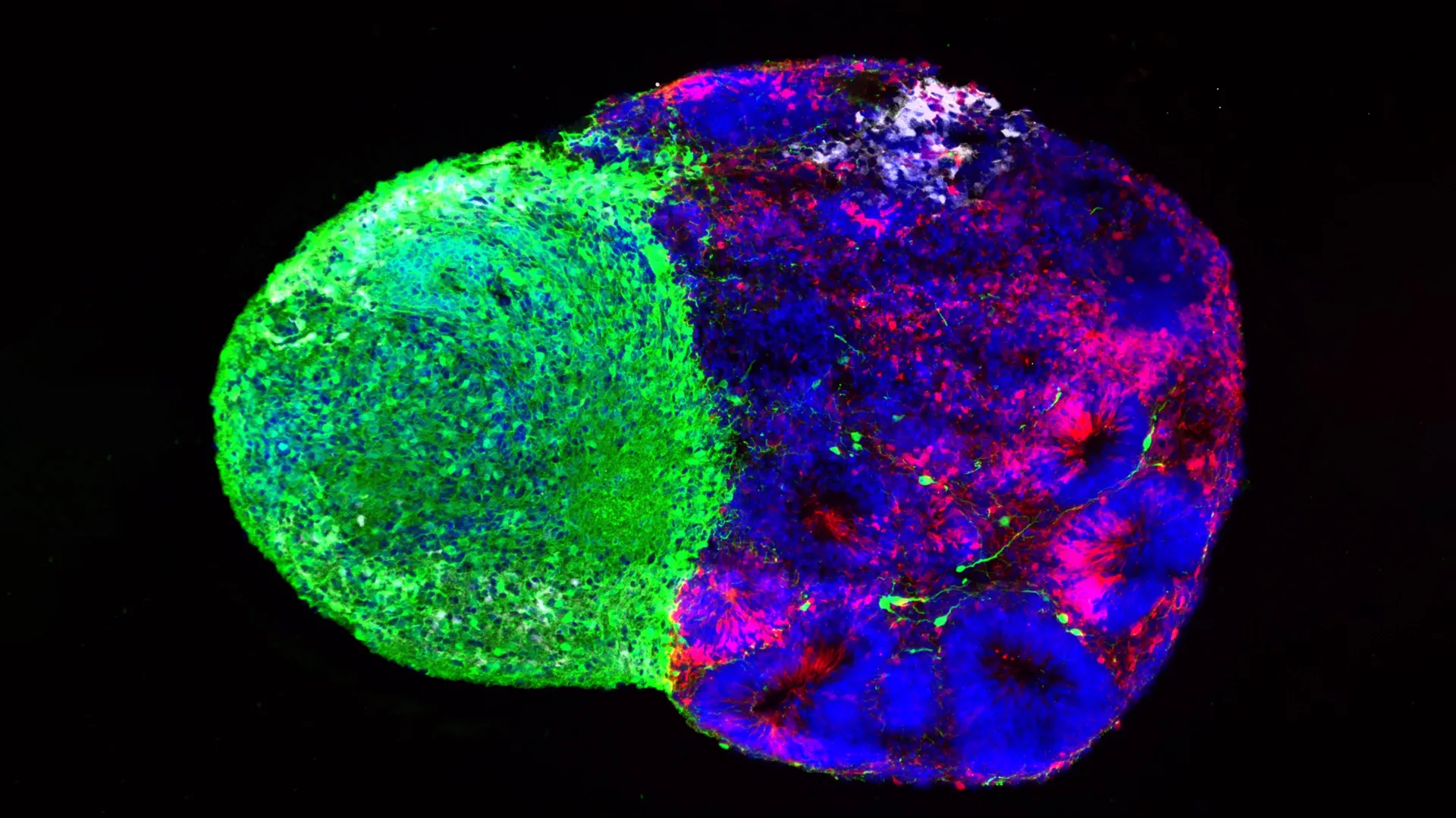 UCLA Finds How Brain Stem Cells Build Human Intelligence