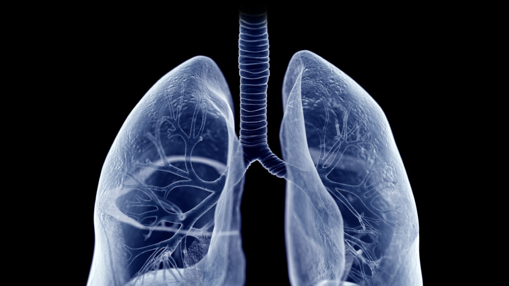 Medical researcher examining lung scan imagery showing improved blood flow in pulmonary arteries