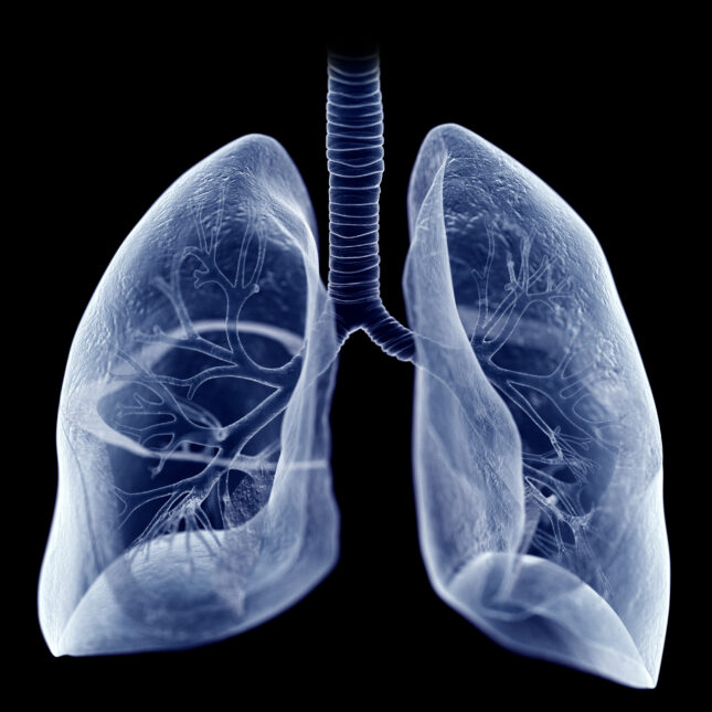 Roivant Drug Shows 56% Success Against Lung Disease - Image 2