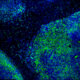 Cancer Drug Discovery Launches $50M Diabetes Startup - Image 5