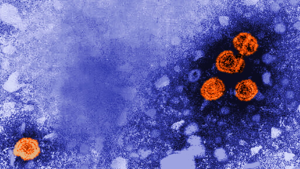 New Hepatitis B Treatment Cures 1 in 5 Patients