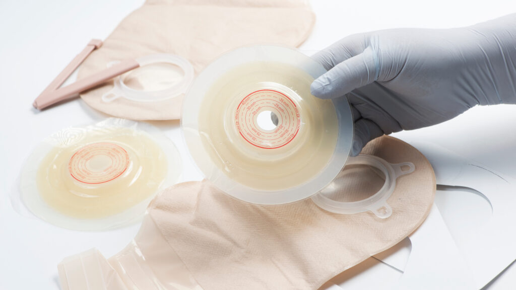 Doctor Fights for 1M Ostomy Patients' Medical Supply Access