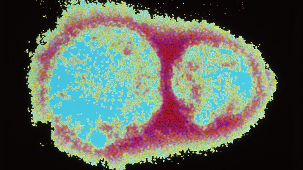 Epidemiologist Builds Early-Warning System Against Misinfo