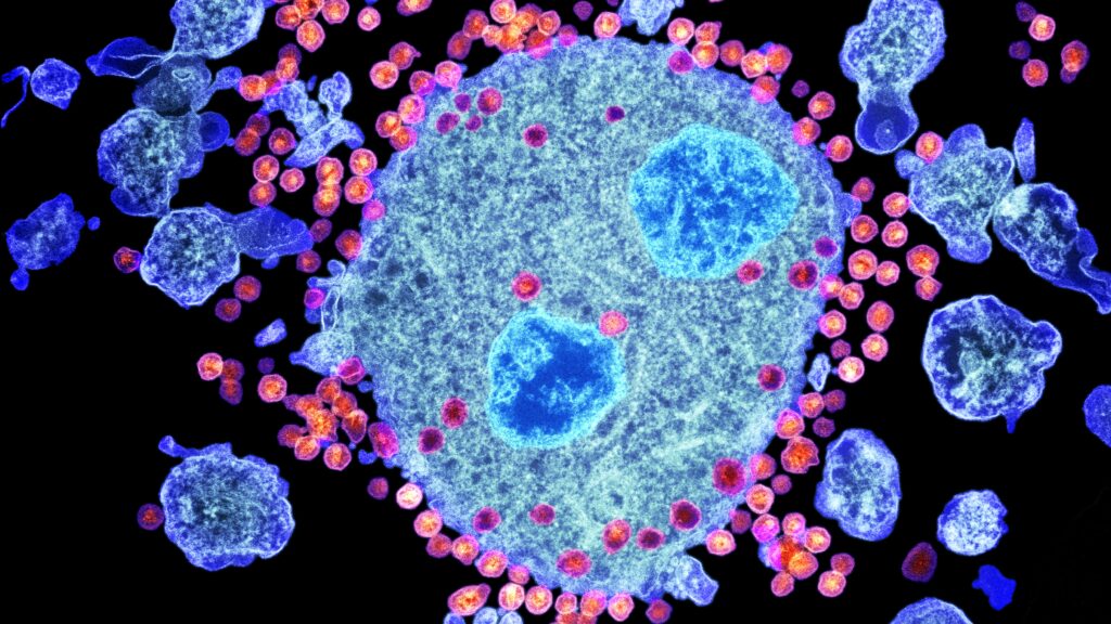 HIV particles budding from surface of human T lymphocyte cell under microscope