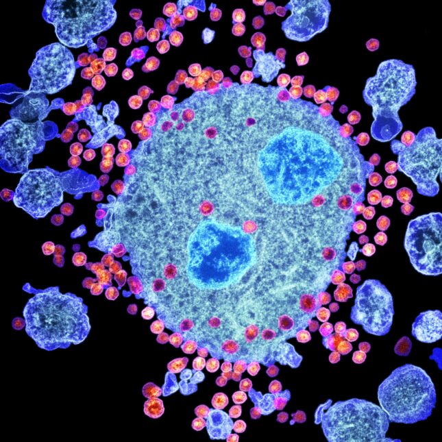 50 Years Later: Discovery That Led to HIV Test and Cancer Cure - Image 2