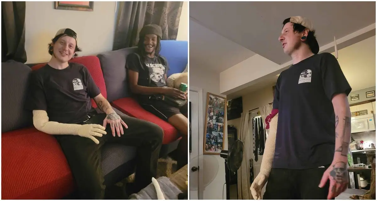 Cousin Crochets Replacement Arm for Kentucky Amputee