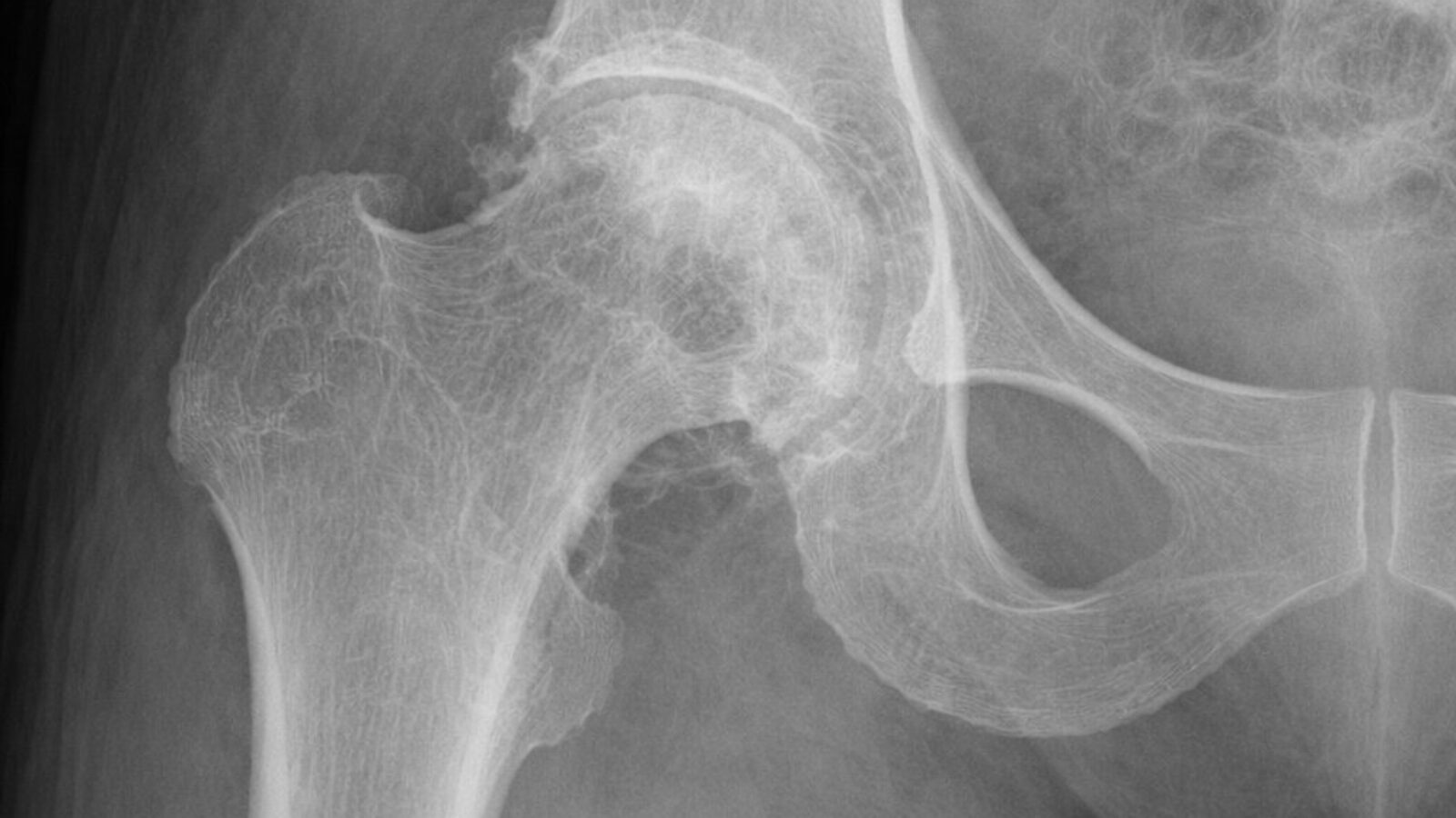Simple ER Changes Could Help Millions With Dementia - Image 4