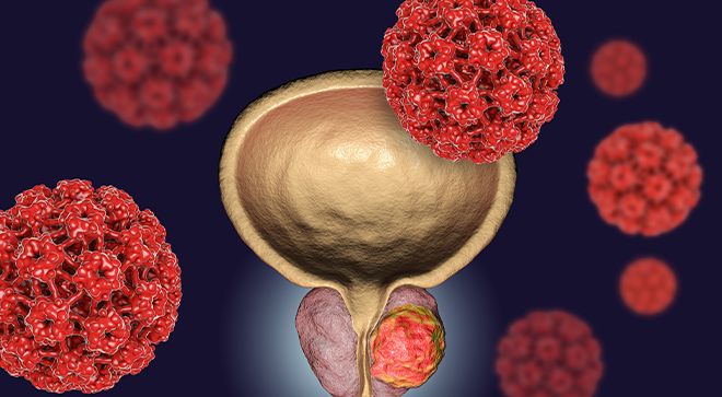 New Cell Therapy Shows Promise for Blood Cancer Patients