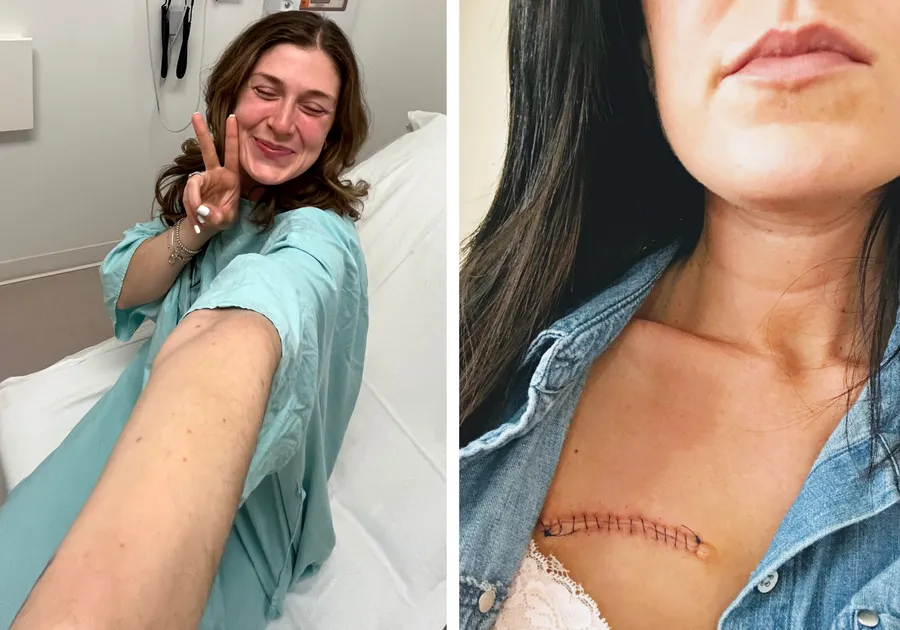 26-Year-Old Beats Melanoma, Now Saves Lives Online