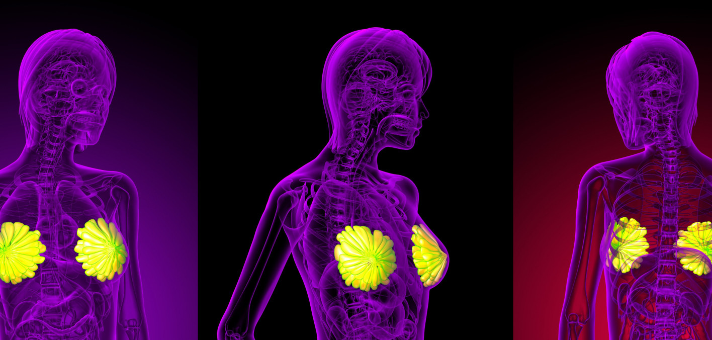 FDA Approves 5 New Breast Cancer Treatments in 2026