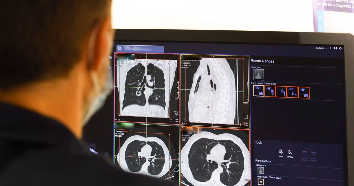 AI Detects Pancreatic Cancer 16 Months Before Doctors - Image 2