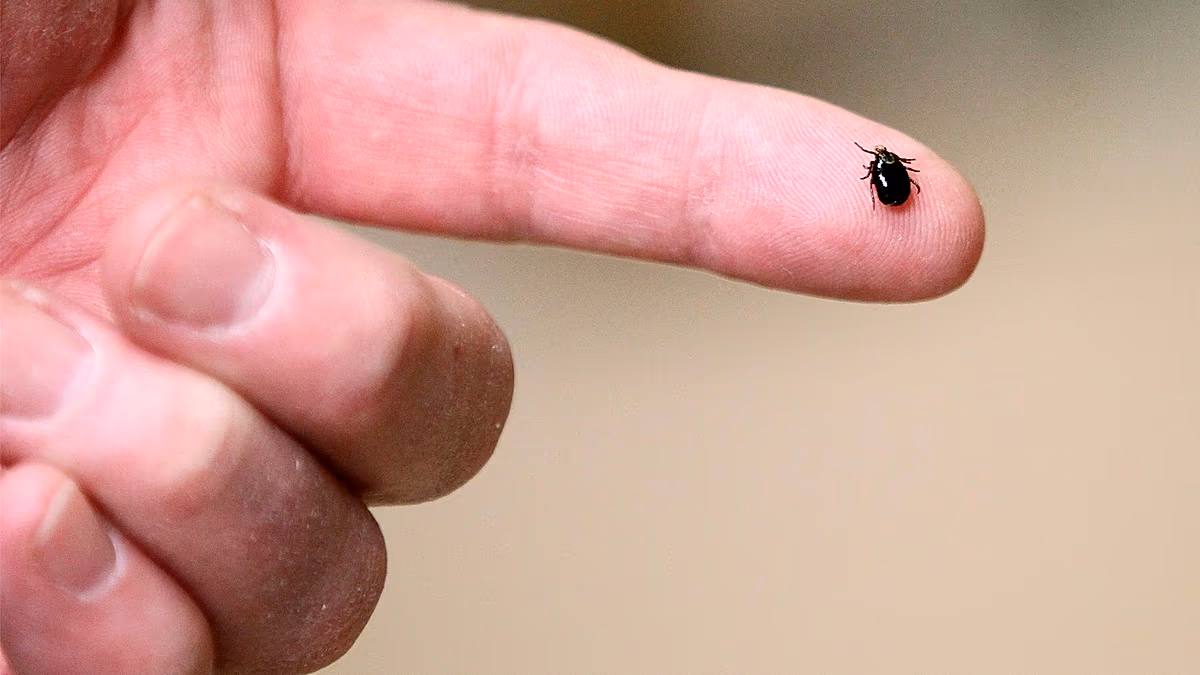 First Lyme Disease Vaccine Shows 73% Success in Trials