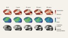 5 Psychedelics Show Similar Brain Patterns in 500+ Scans - Image 4