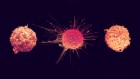 Four Cancer Researchers Shaping Tomorrow's Treatments - Image 3