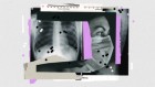 New MS Treatment Creates Healing Cells Inside the Body - Image 2