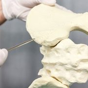 Robot Performs Radiation-Free Bone Biopsies on Kids - Image 2